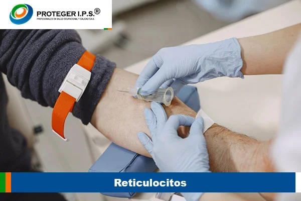 Reticulocitos