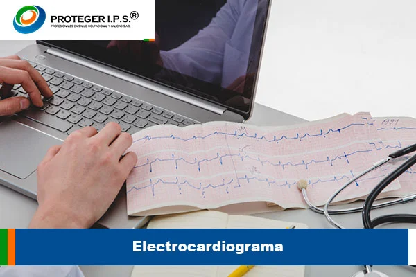 electrocardiograma